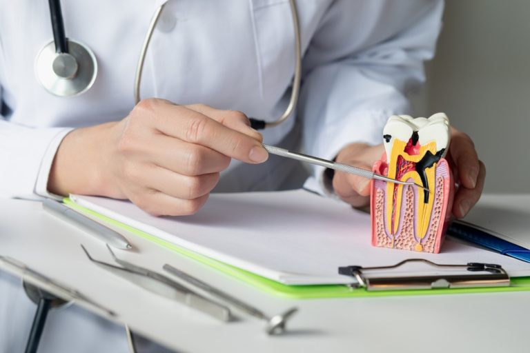 Understanding Root Canal Treatment: What You Need to Know