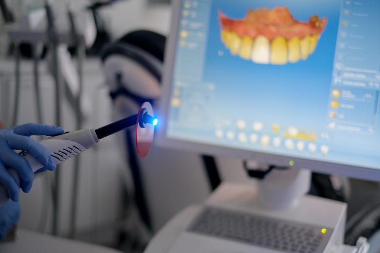 The Benefits of CEREC Technology for Same-Day Crowns