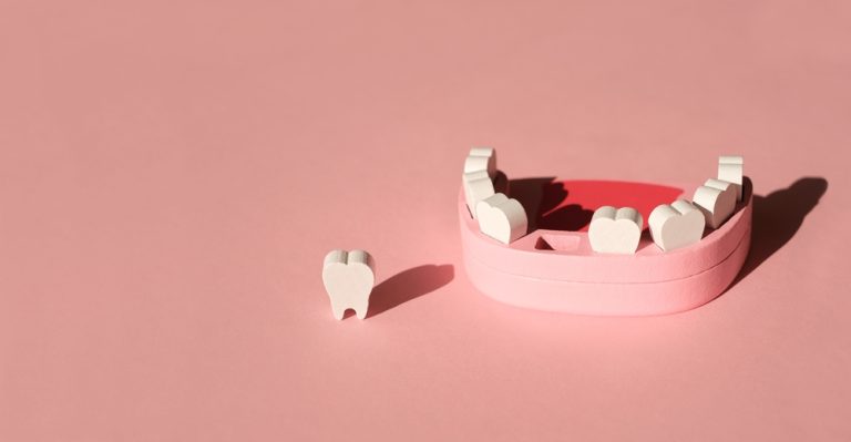 What To Do If You Lose a Tooth