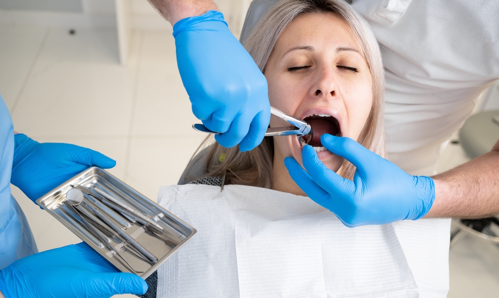 A dentist in blue latex gloves removes her tooth with a buccal retractor and forceps.