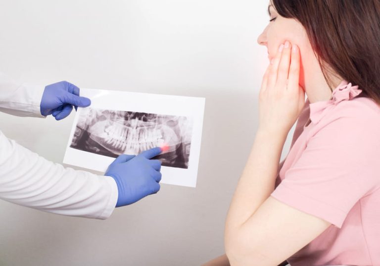 A dentist doctor is holding a panoramic X-ray picture of a female patient who has an inflamed dental cyst, a neoplasm